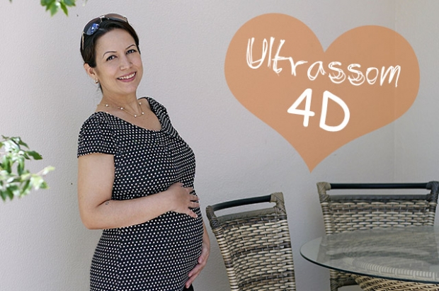 Ultrassom 4D da Lis